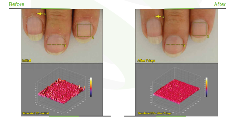 Nanovetores Tecnologia S.A. Nano Nails Efficacy Studies - 2