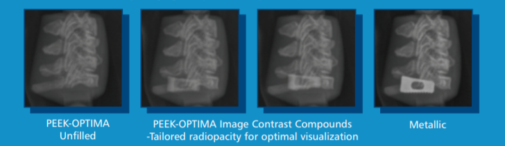 PEEK-OPTIMA™ Image Contrast (Low radioactivity) - X-Ray Imaging Comparison of Spinal Implants in A Phantom