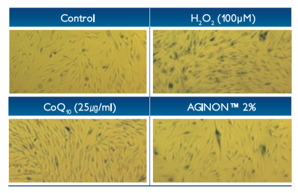 Aginon™ - Main Biological Effects For Cosmetics - 2