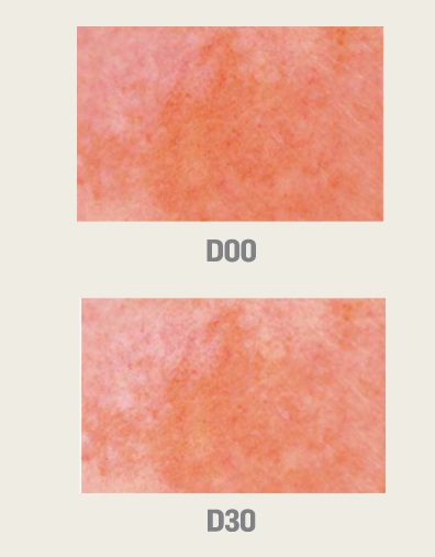 QUIDITAT NWP - Skin Spots - 1