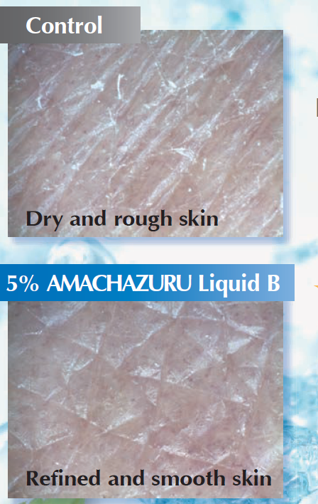 AMACHAZURU Liquid B - Moisture Healing By Aquaporin - 1