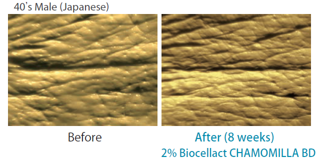 Biocellact CHAMOMILLA BD - Ta Stem Cells Anti Wrinkle Effect
