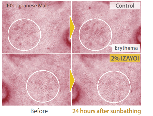 IZAYOI - Suppression of Erythema Caused By Uv Rays - 1