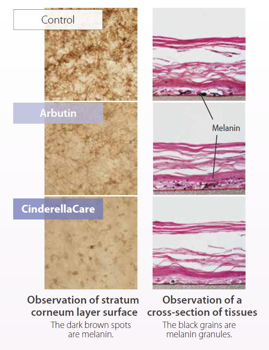 CinderellaCare - Observation of Stratum Corneum Layer Surface