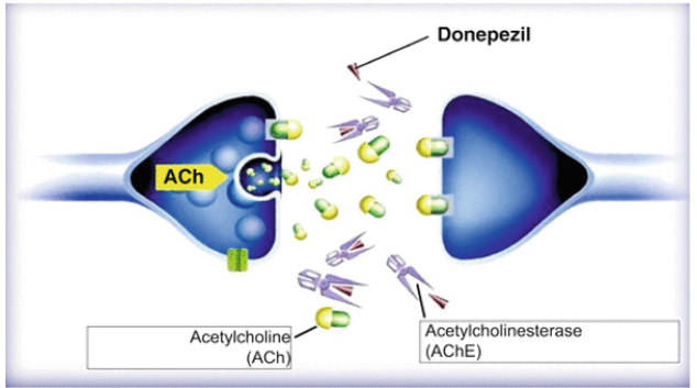 Alfa Chemistry Materials Donepezil - Application in The Treatment of Alzheimer'S Disease - 1