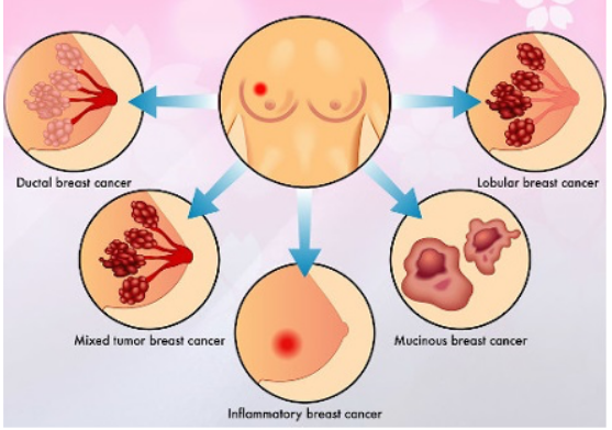 Alfa Chemistry Materials Tamoxifen - Function of Tamoxifen Citrate in The Treatment of Breast Cancer