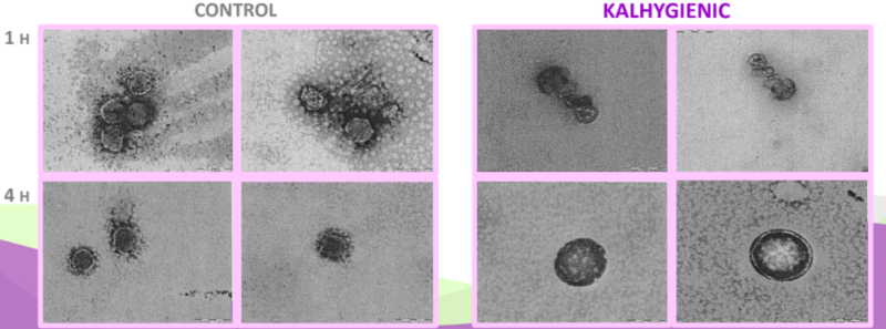 Kalhygienic Oris - Activity of Kalhygienic Vs Coronavirus
