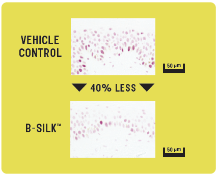 B-Silk™ Protein - B-Silk™ Defends Against Environmental Aggressors & Visibily Improves Skin - 1