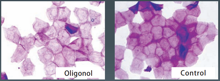 ADS-Oligonol - Normalization of Stratum Corneum
