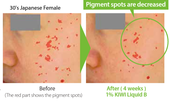 KIWI Liquid B - Whitening Effect On Human Skin - 1