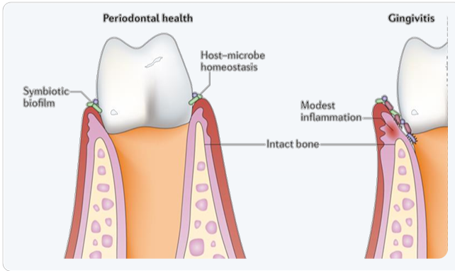 KALIDENT™ PF - Oral Microbiota Keeping