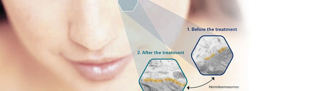 Serilesine® peptide solution GC banner