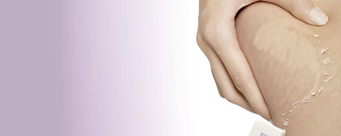 Vanistryl®  banner