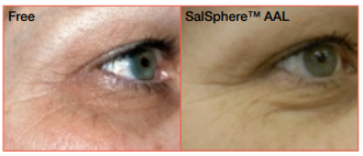 salsphere anti aging lift
